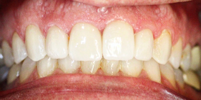 After dental treatment with our Green Bay Dentists