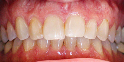 Before dental treatment with our Green Bay Dentists