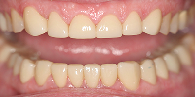 After dental treatment with our Green Bay Dentists