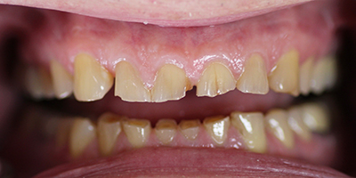 Before dental treatment with our Green Bay Dentists