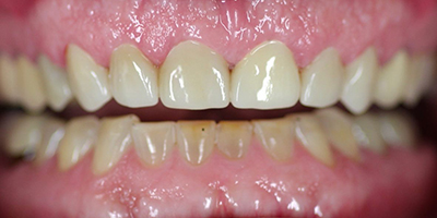 After dental treatment with our Green Bay Dentists