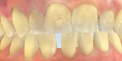 Before dental treatment with our Green Bay Dentists