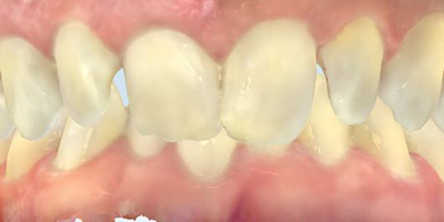 Before dental treatment with our Green Bay Dentists