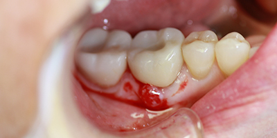 After dental treatment with our Green Bay Dentists