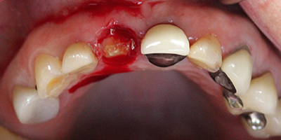Before dental treatment with our Green Bay Dentists