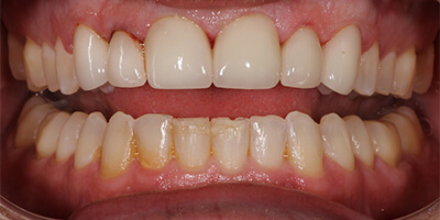 Before dental treatment with our Green Bay Dentists