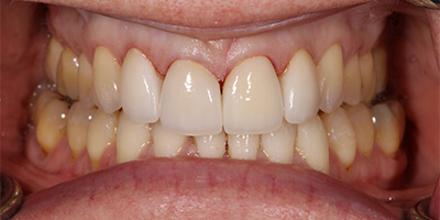 After dental treatment with our Green Bay Dentists