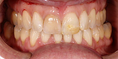 Before dental treatment with our Green Bay Dentists